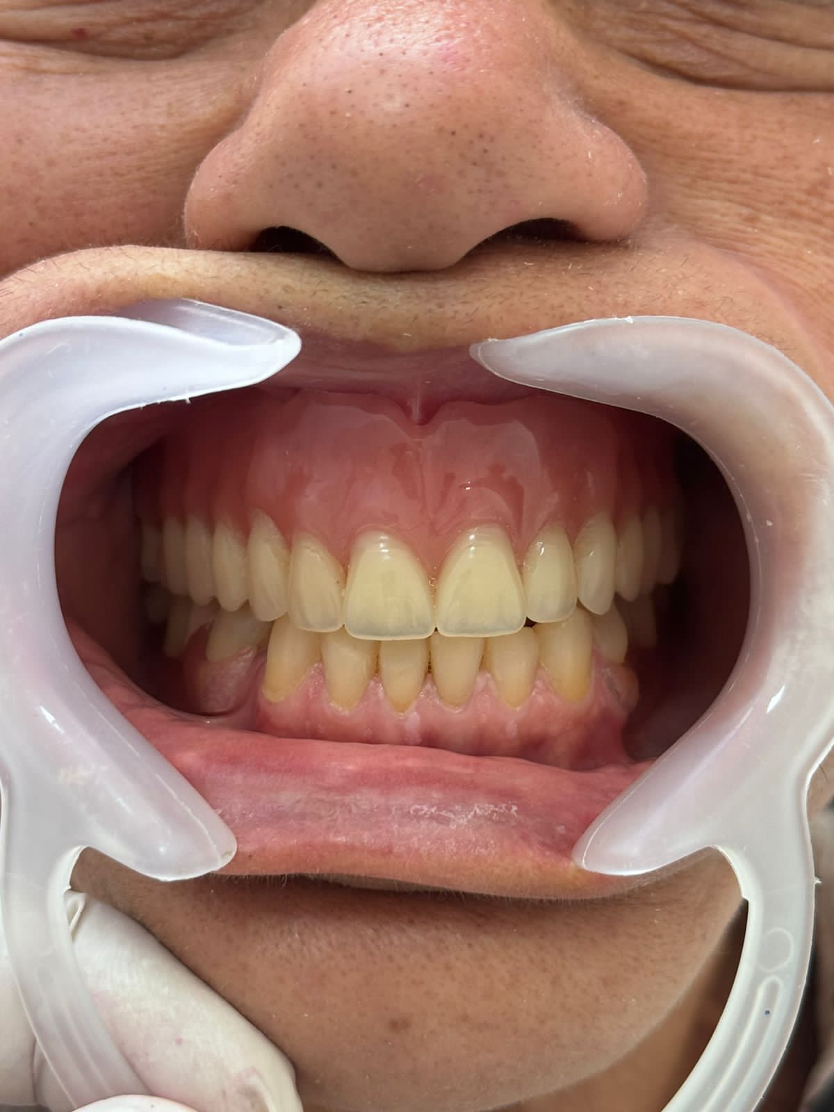 Elegancia Dental