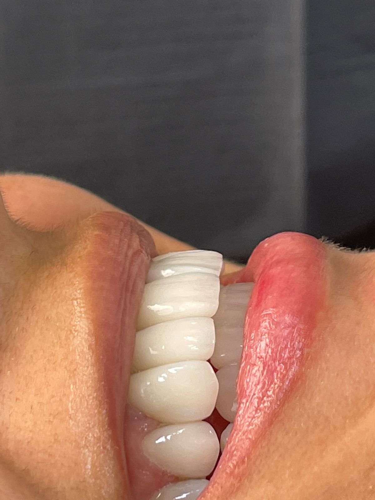Sonrisa de Celebridad